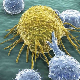 Liệu pháp miễn dịch tự nhiên: Tự tiêu diệt, kiểm soát ung thư