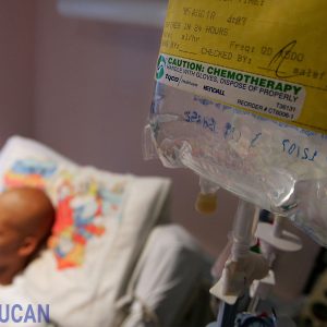 hóa xạ trị ưng